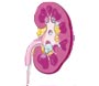 about kidney stones 1