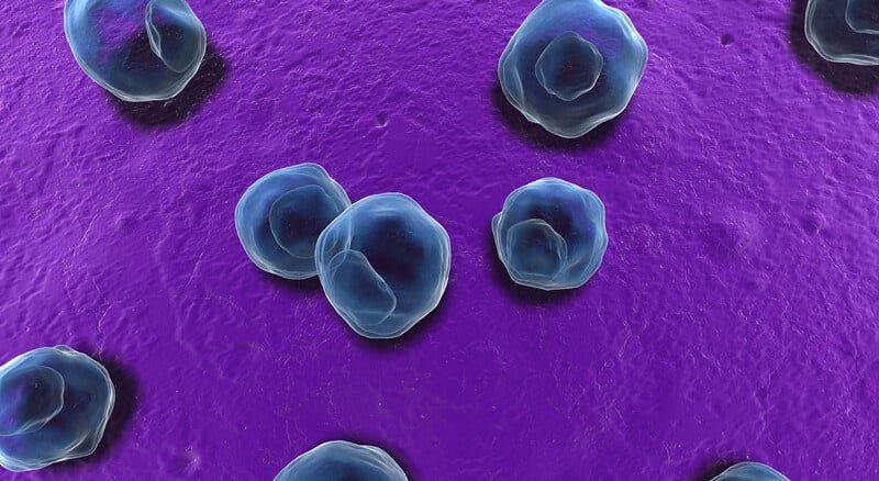 chlamydia diet