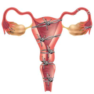 UTERUS