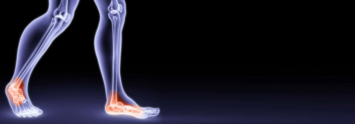Athlete's Foot