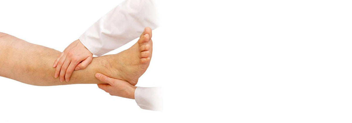 Edema