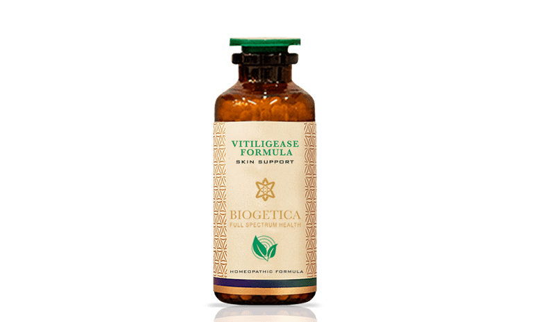 Vitiligease Formula
