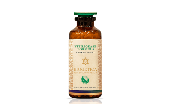 Vitiligease Formula